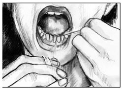 Drawing showing a woman&rsquo;s mouth as she flosses her lower front teeth.
